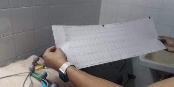 Electrocardiogramas